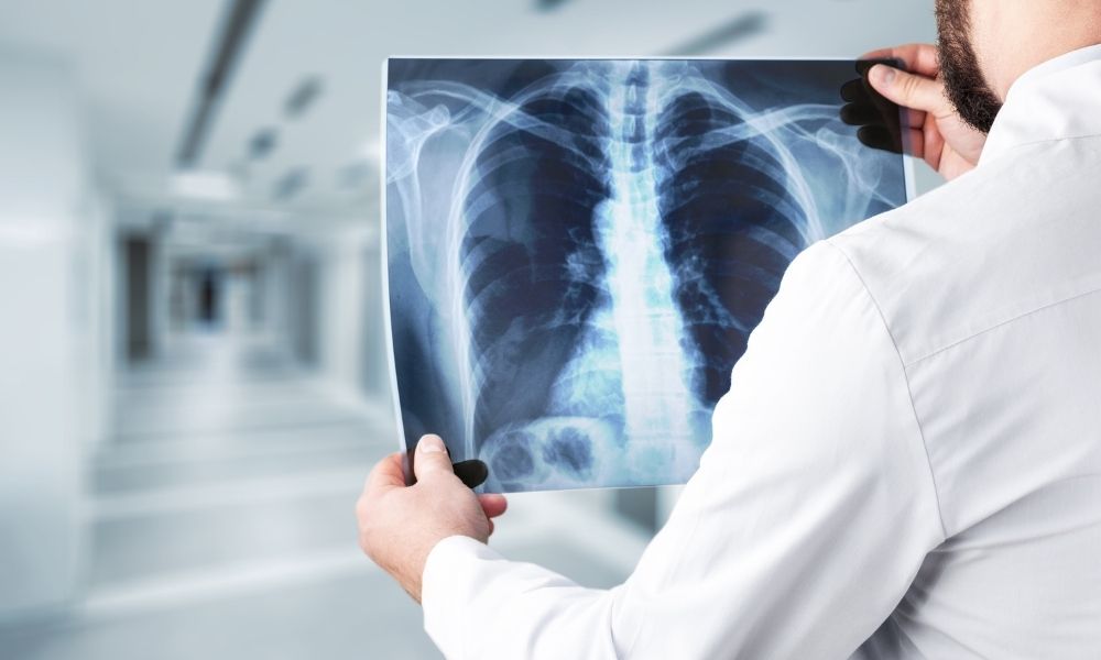 X-Ray Radiology — DSMC Karachi